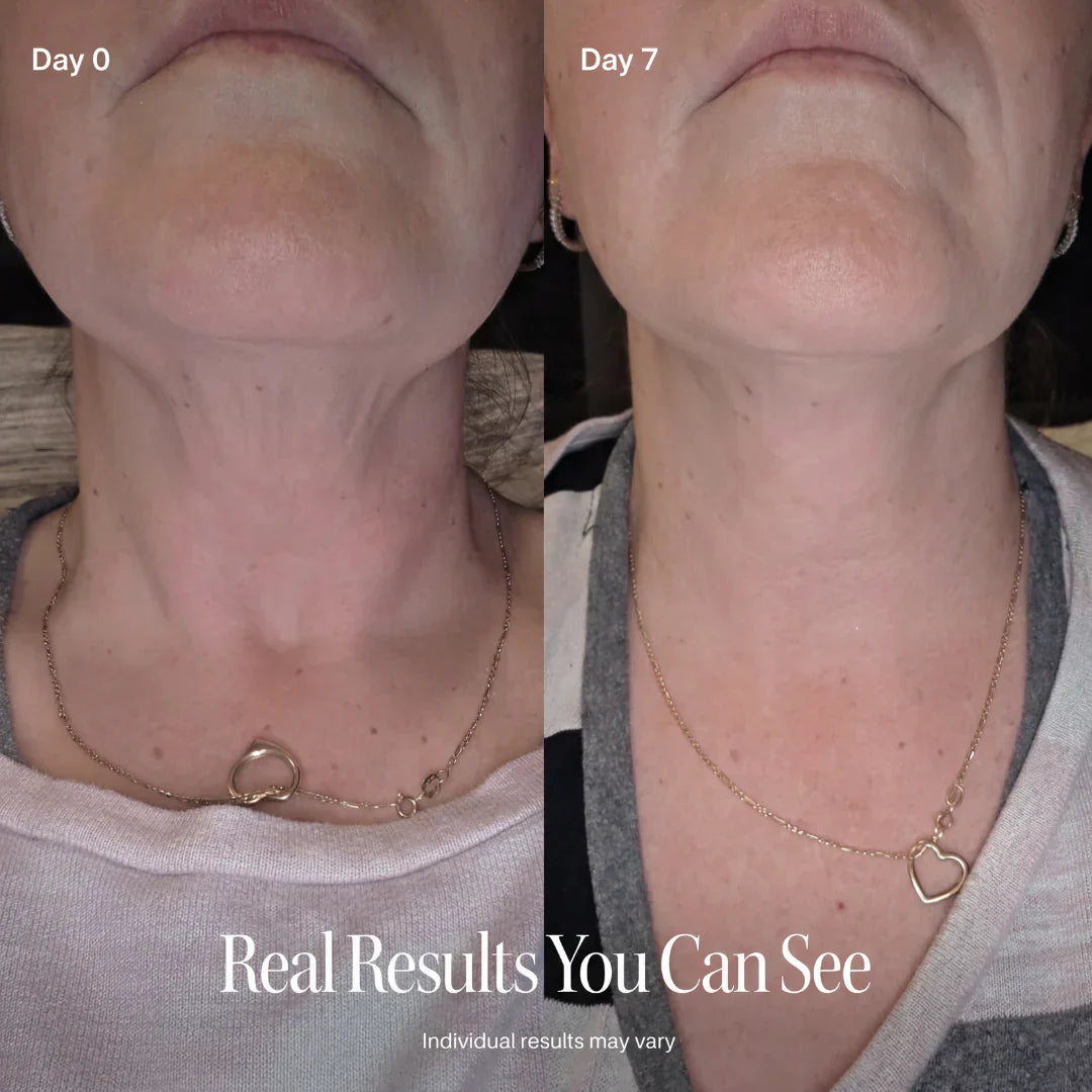 š„LAST DAY BUY 1 GET 1 FREEš„CELESTVĆRA Face Slimming Cream