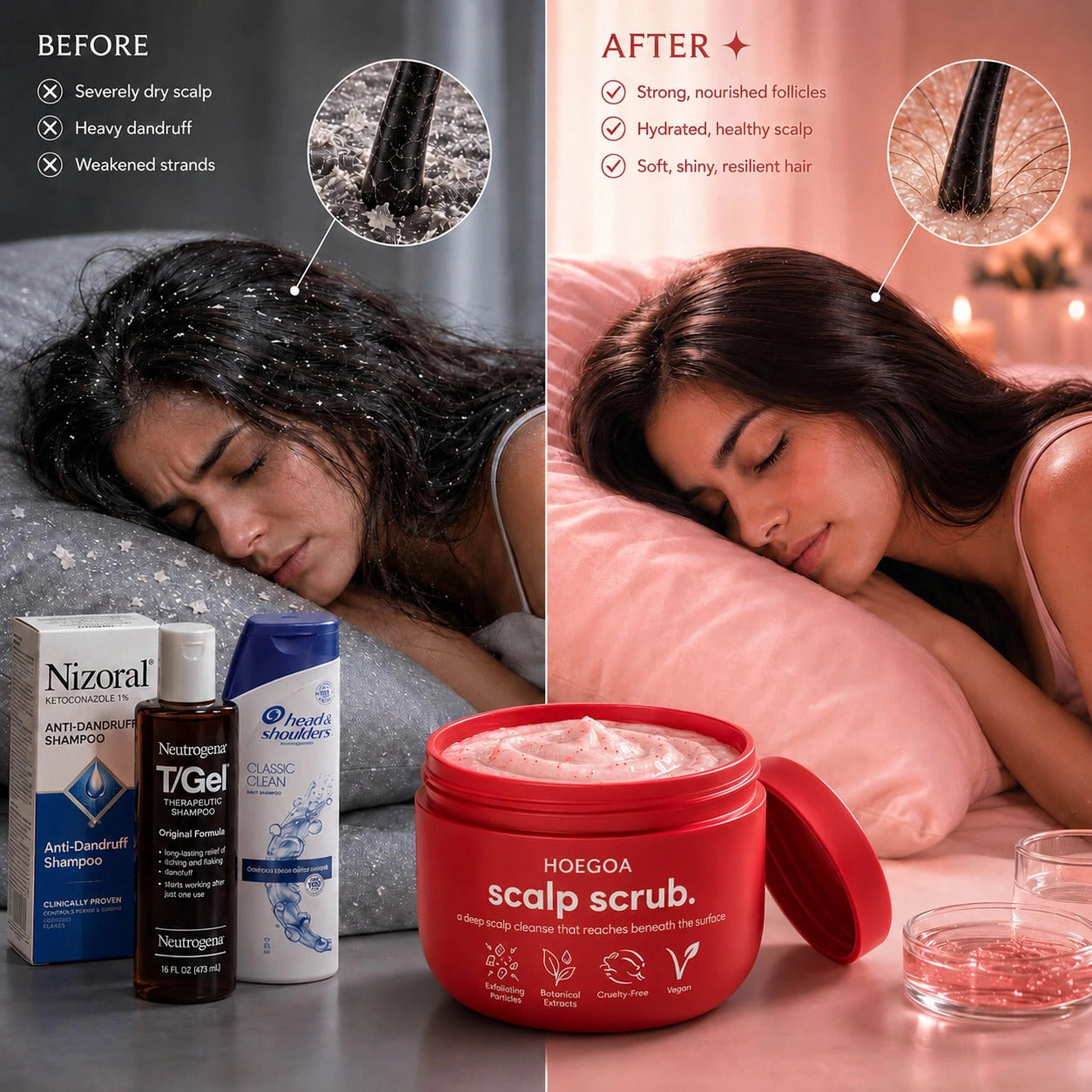 Your Medicated Shampoo Is Breaking Your Scalp.