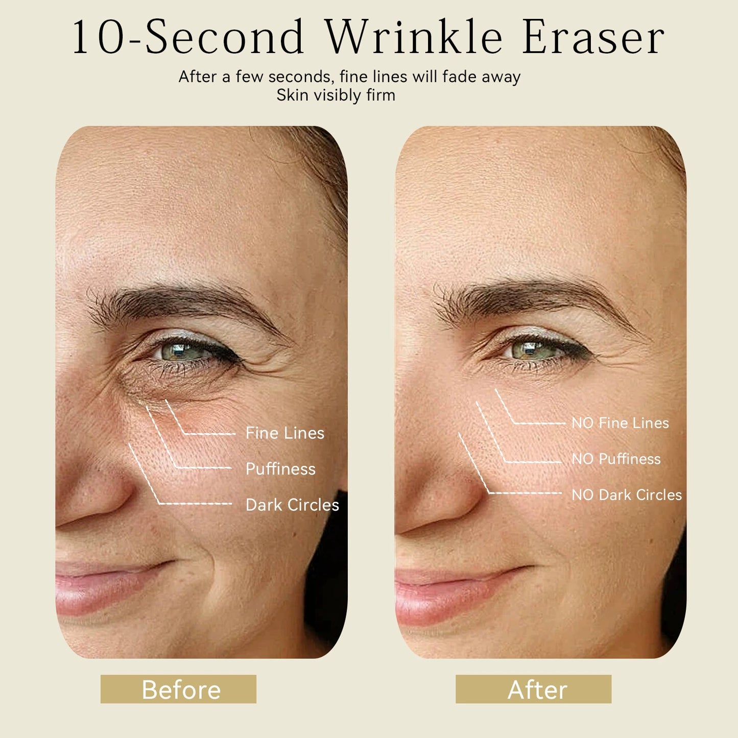 Eye Roller for Puffiness | Removes 97% of under-eye bags in 60 seconds — Instantly look 10 years younger!