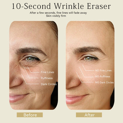 Eye Roller for Puffiness | Removes 97% of under-eye bags in 60 seconds — Instantly look 10 years younger!