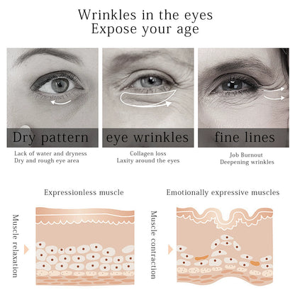 Eye Roller for Puffiness | Removes 97% of under-eye bags in 60 seconds — Instantly look 10 years younger!
