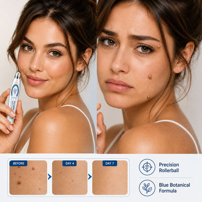 The 7-Day Botanical Precision Care Routine Your Skin Tags Aren't a Sign of Aging. They're Your Body's Alarm Bell.