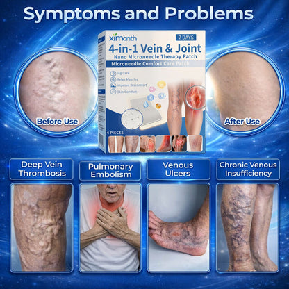 Stop Wasting Money on Useless Varicose Vein Creams That Can't Penetrate Where It Matters